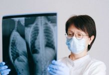 Program Wczesnego Wykrywania Raka Płuca – trwa rekrutacja