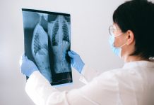 Program Wczesnego Wykrywania Raka Płuca